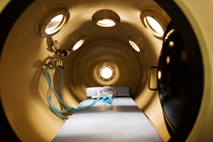 Hyperbaric Oxygen Therapy (HBOT) in Phoenix, AZ